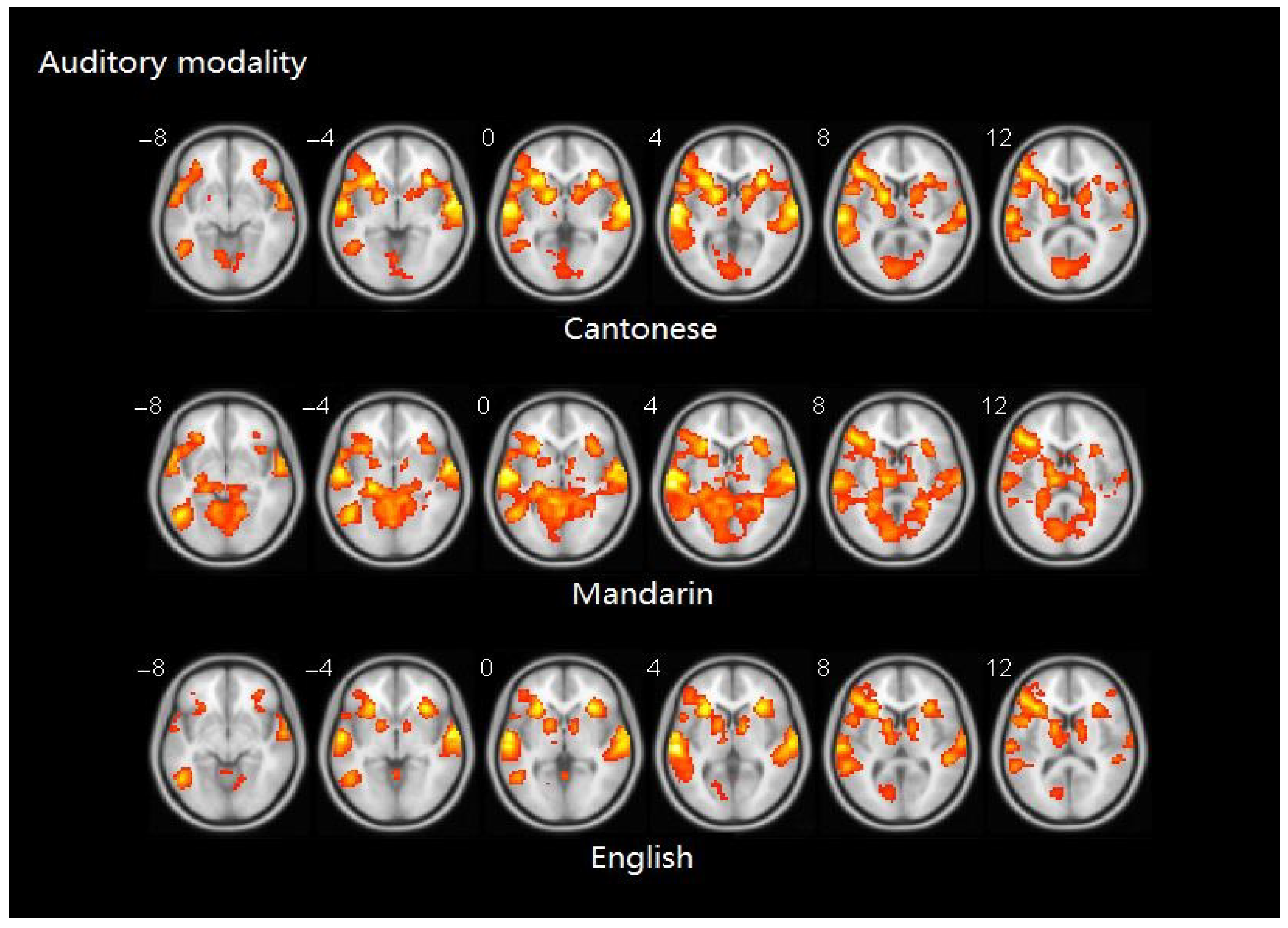 Brainsci 10 00936 g006