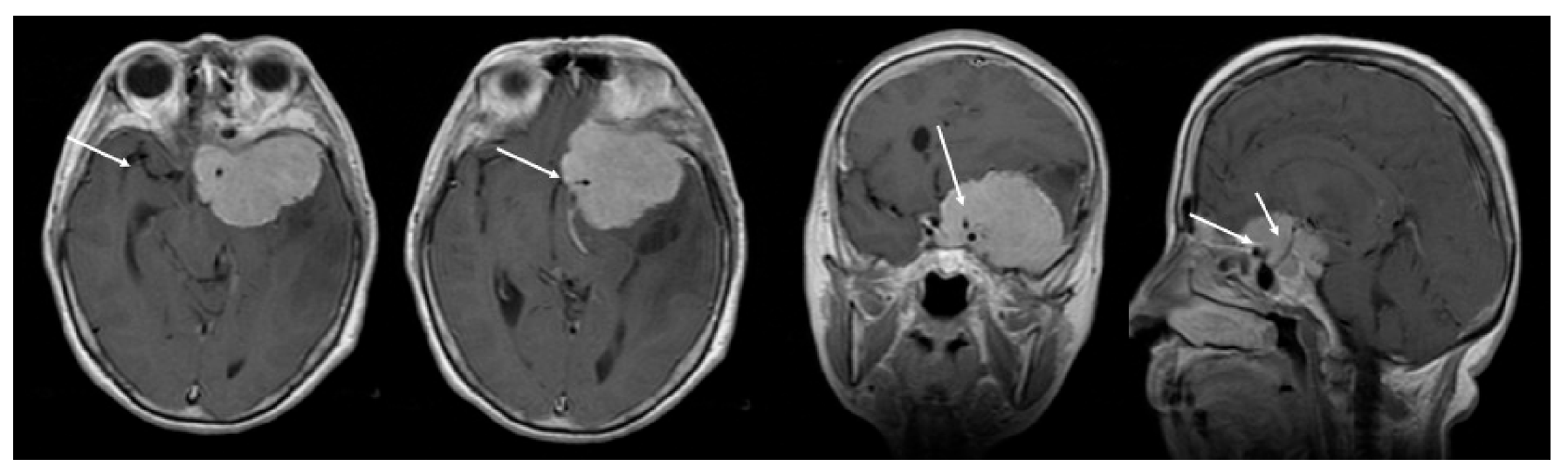 Brainsci 10 00957 g002