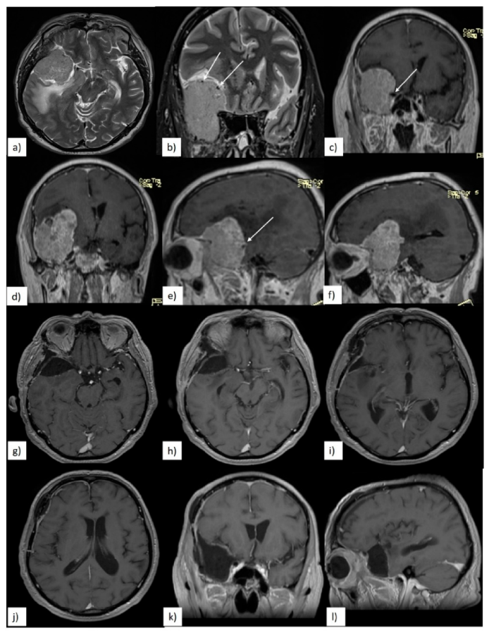 Brainsci 10 00957 g003
