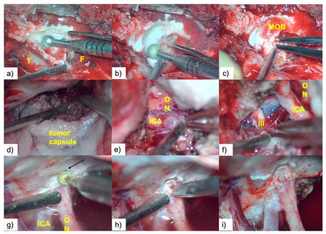 Brainsci 10 00957 g004