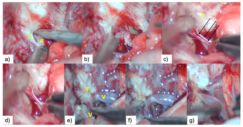 Brainsci 10 00957 g005