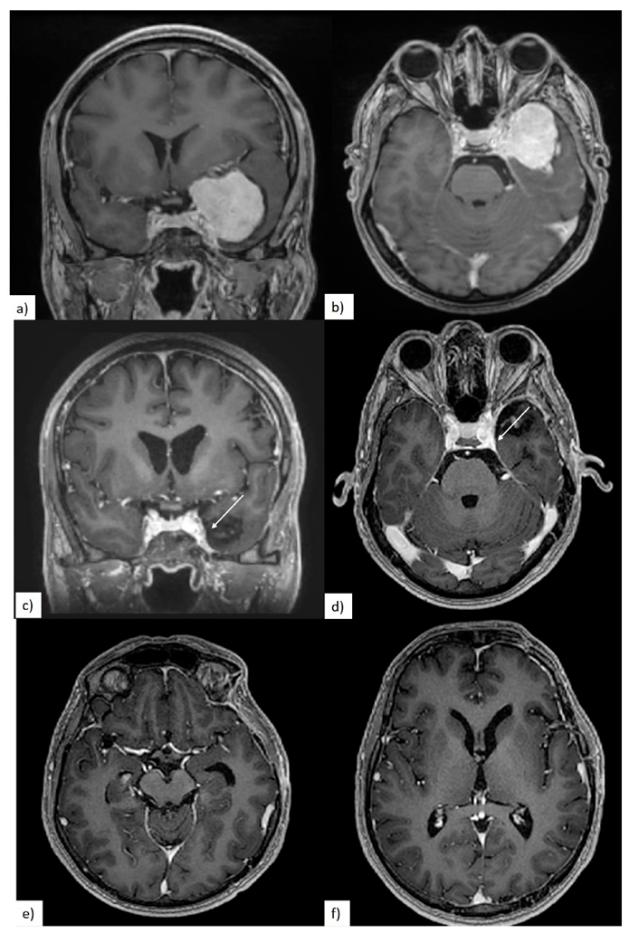 Brainsci 10 00957 g006