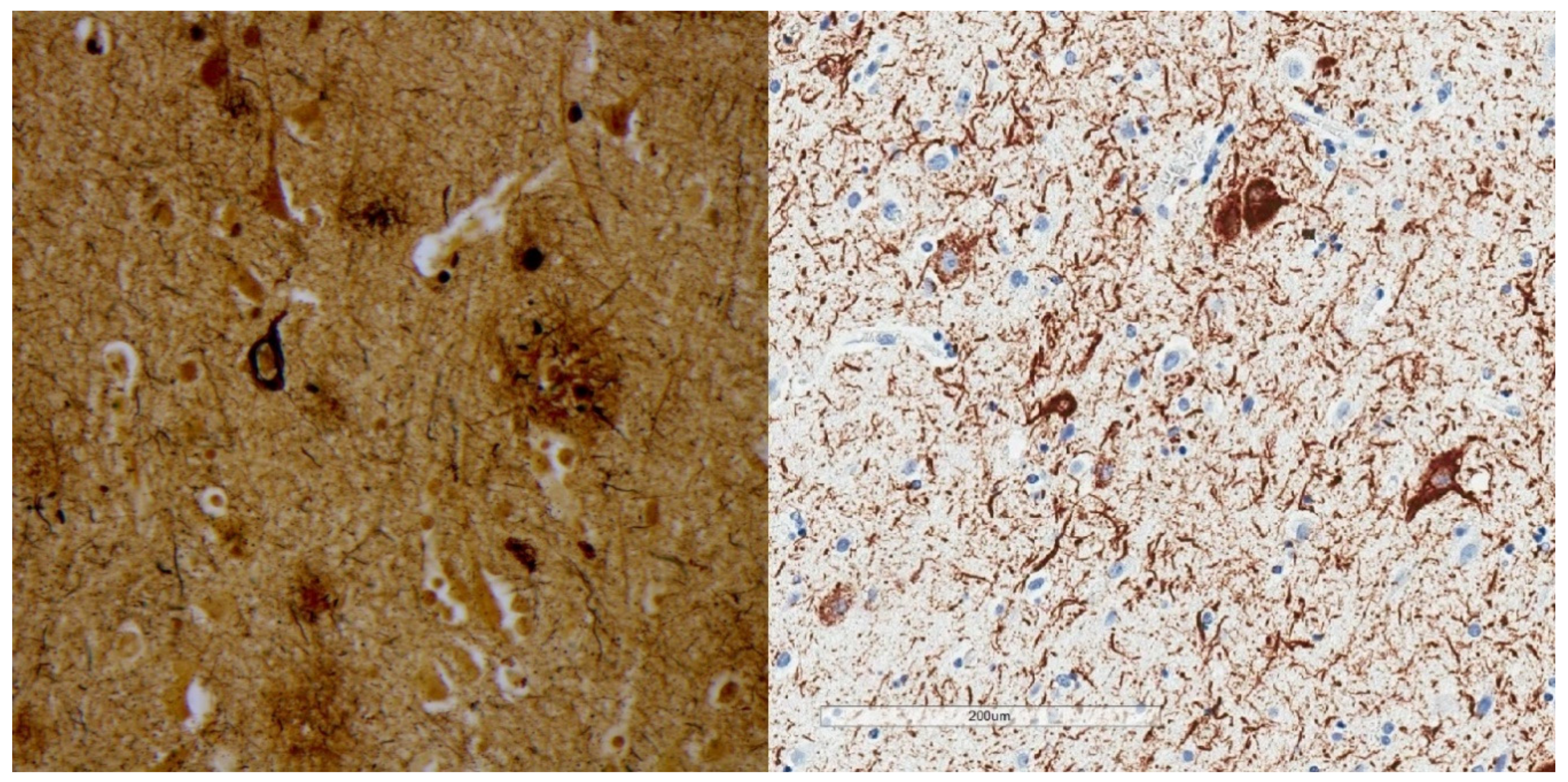 Brainsci 10 00972 g001 Brainsci 10 00972 g001