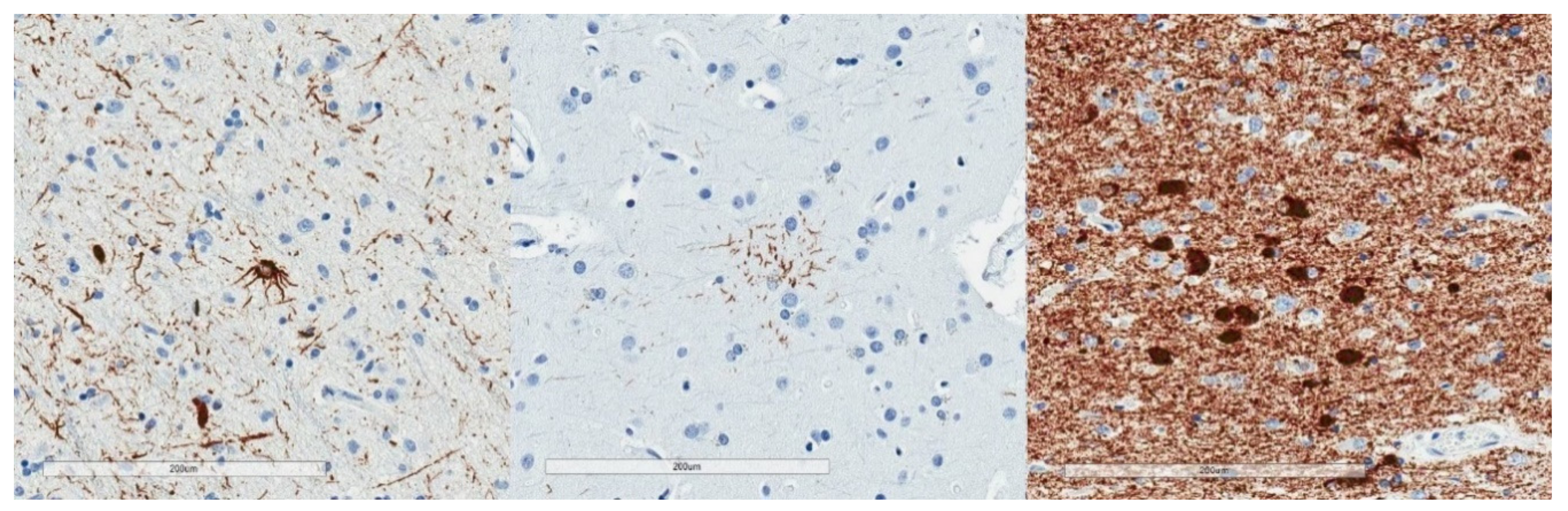 Brainsci 10 00972 g002 Brainsci 10 00972 g002