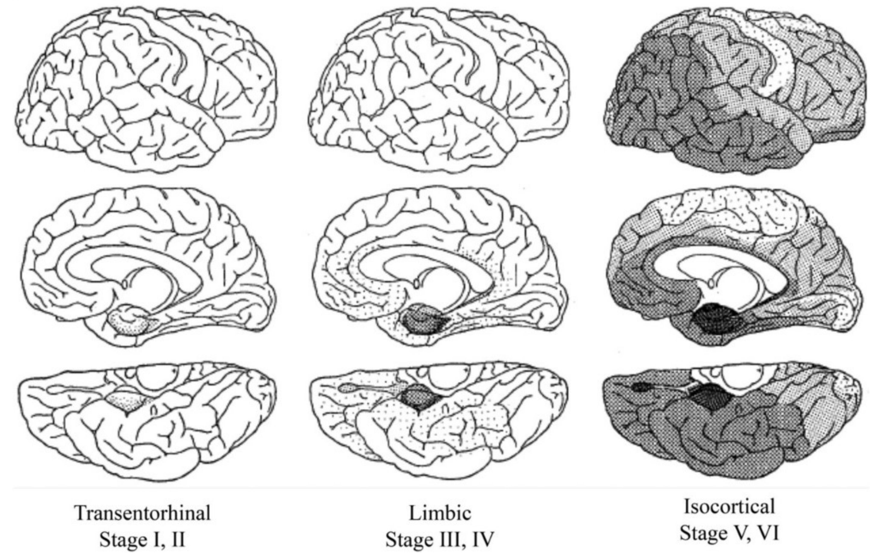 Brainsci 10 00972 g003 Brainsci 10 00972 g003