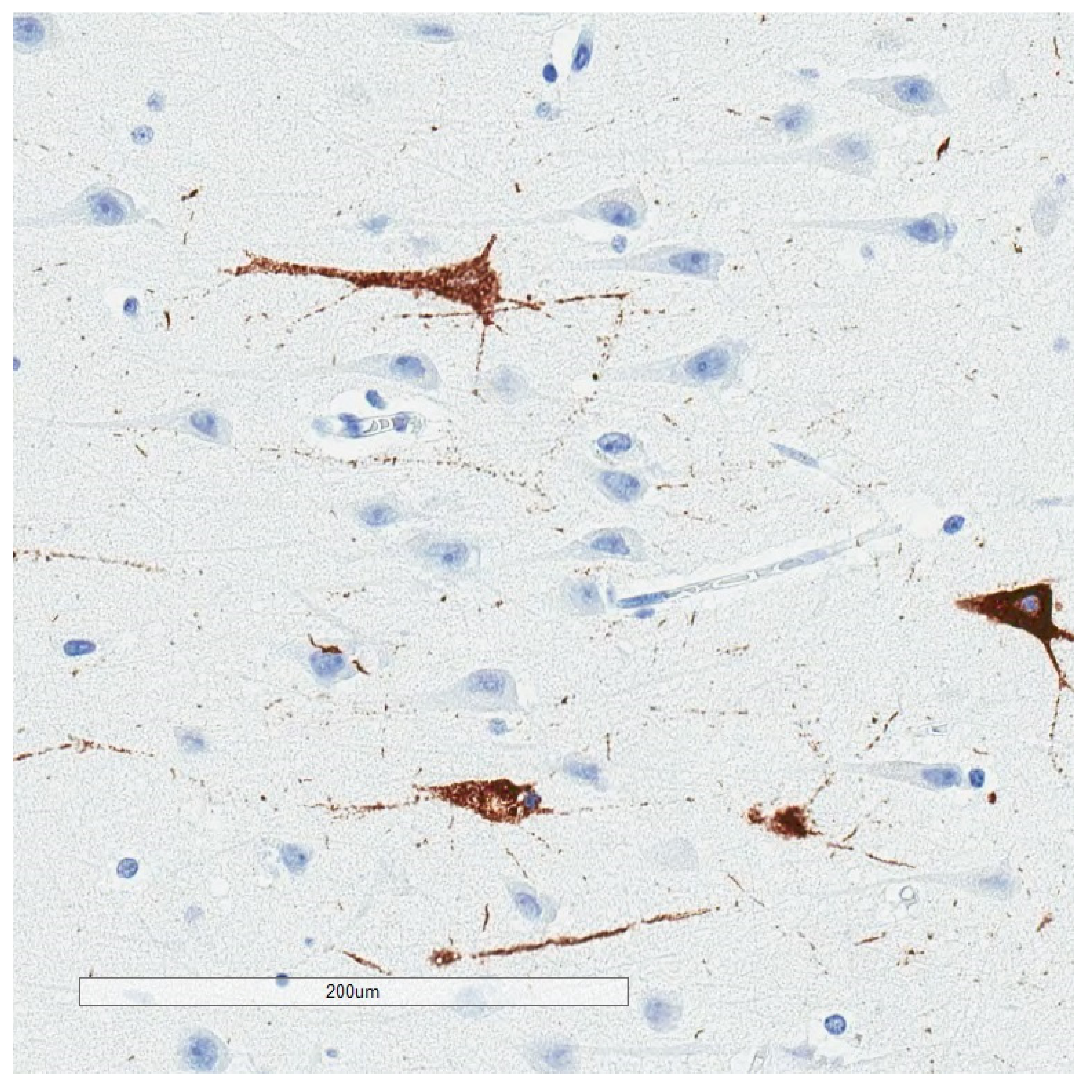Brainsci 10 00972 g007 Brainsci 10 00972 g007