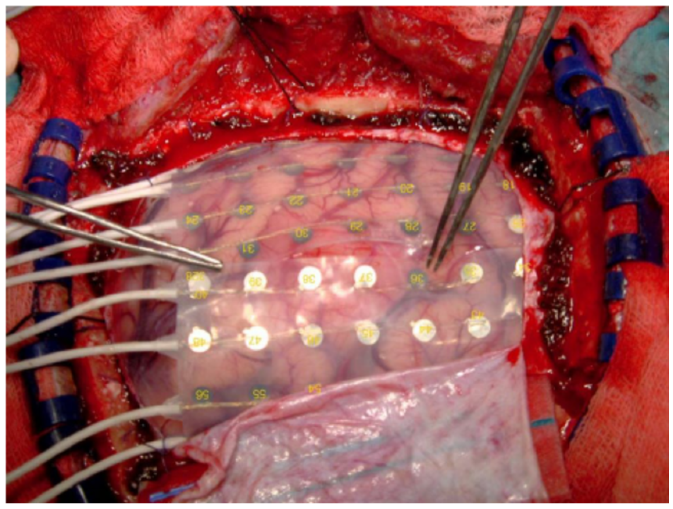 Brainsci 11 00043 g003