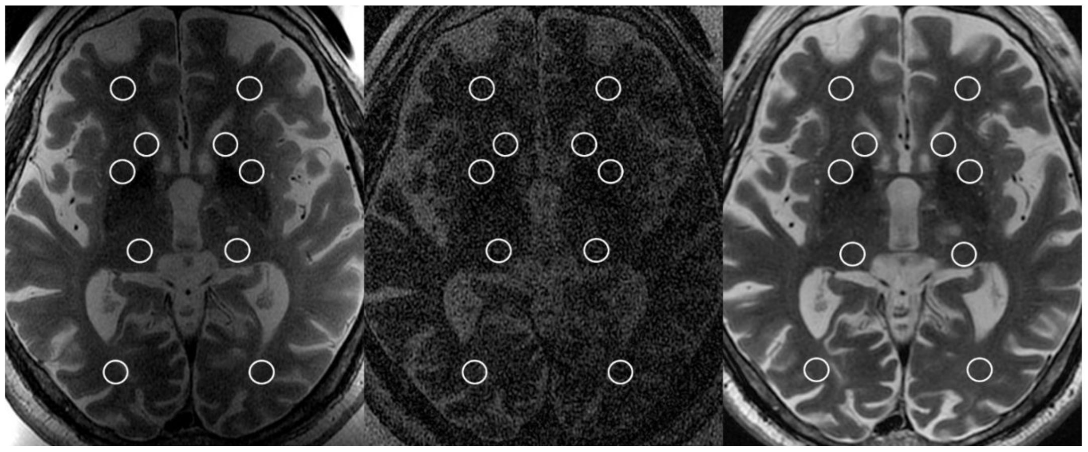 Brainsci 11 00046 g001 Brainsci 11 00046 g001