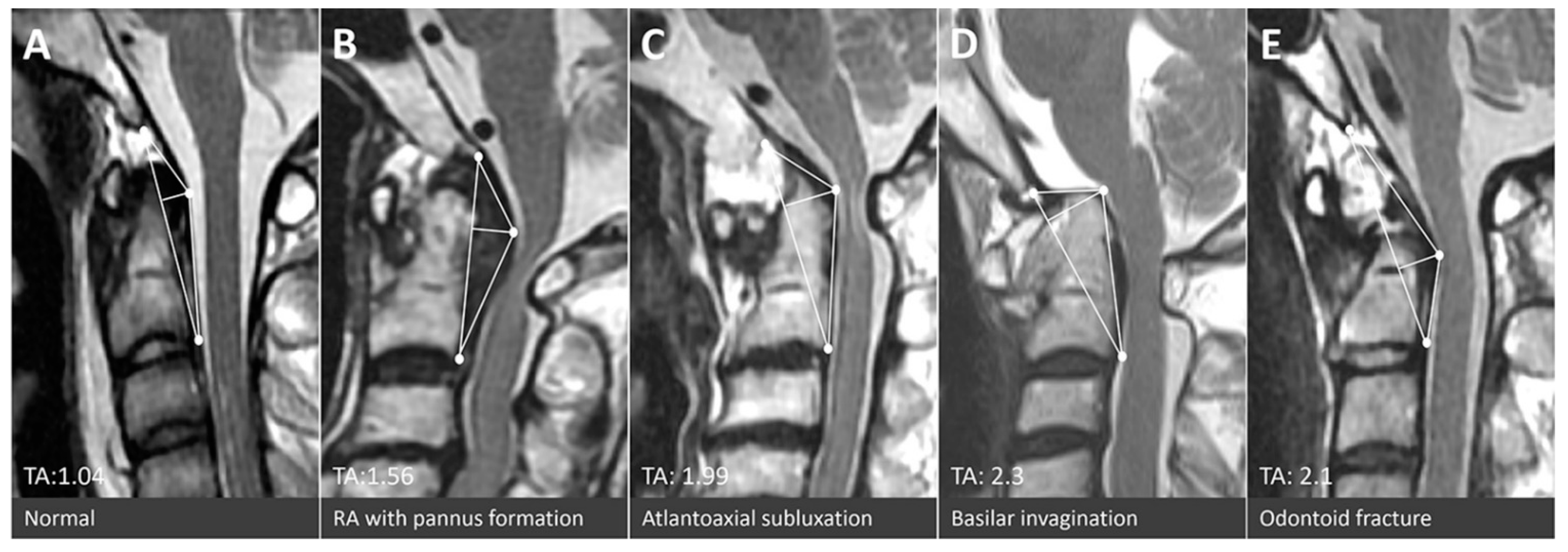 Brainsci 11 00064 g003 Brainsci 11 00064 g003