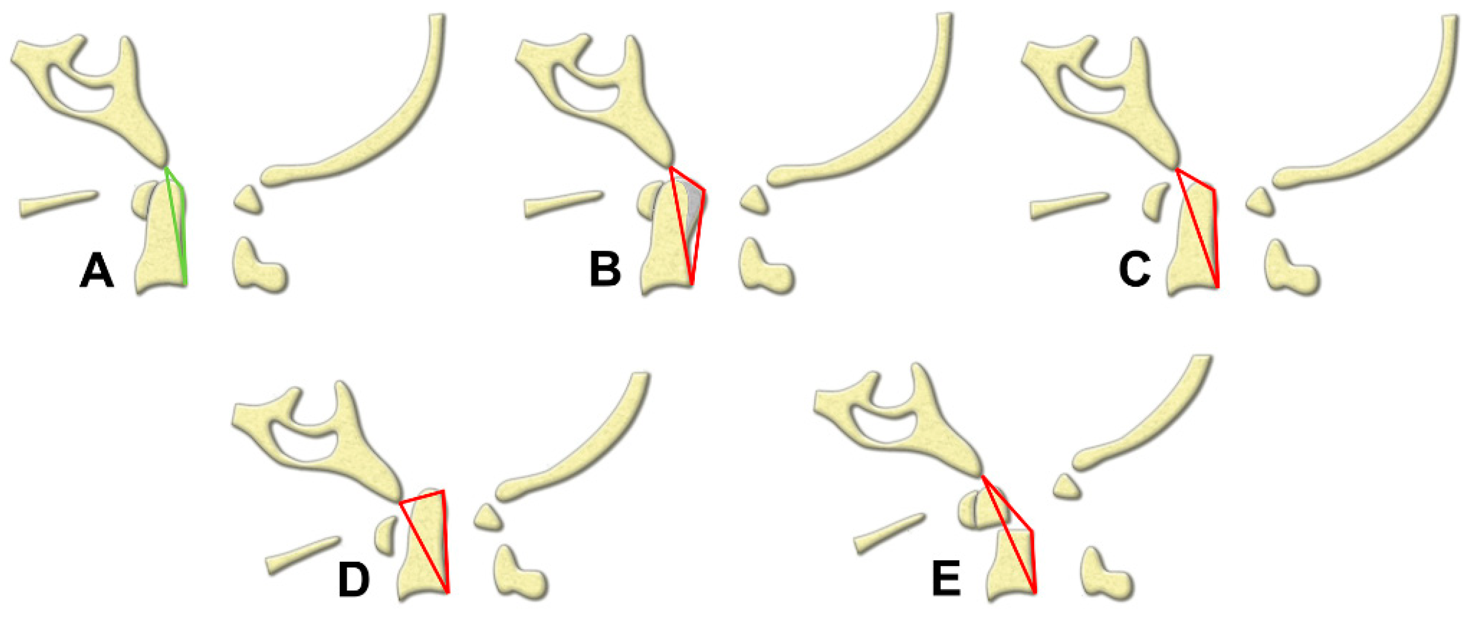 Brainsci 11 00064 g004 Brainsci 11 00064 g004