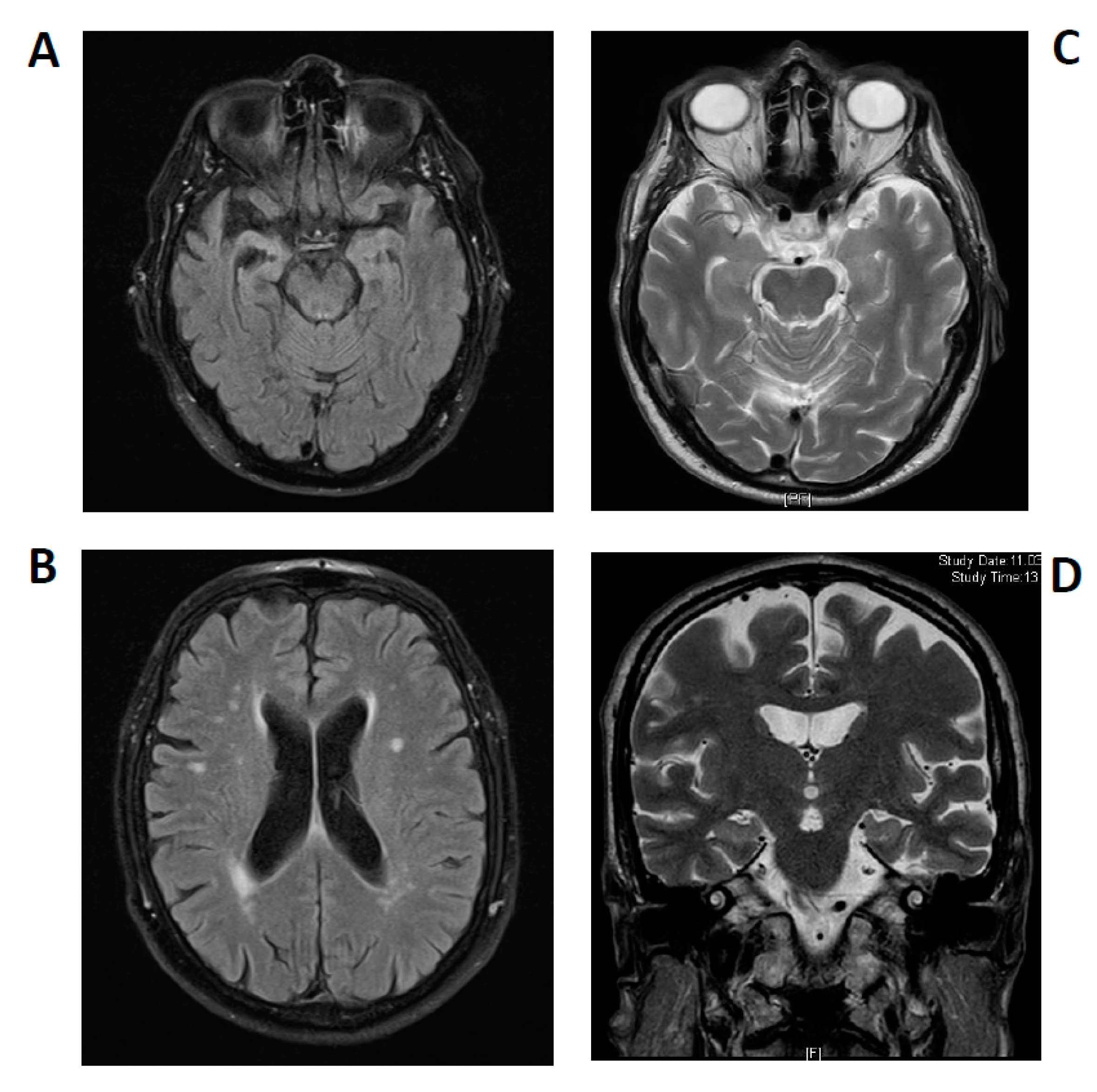 Brainsci 11 00089 g002 Brainsci 11 00089 g002
