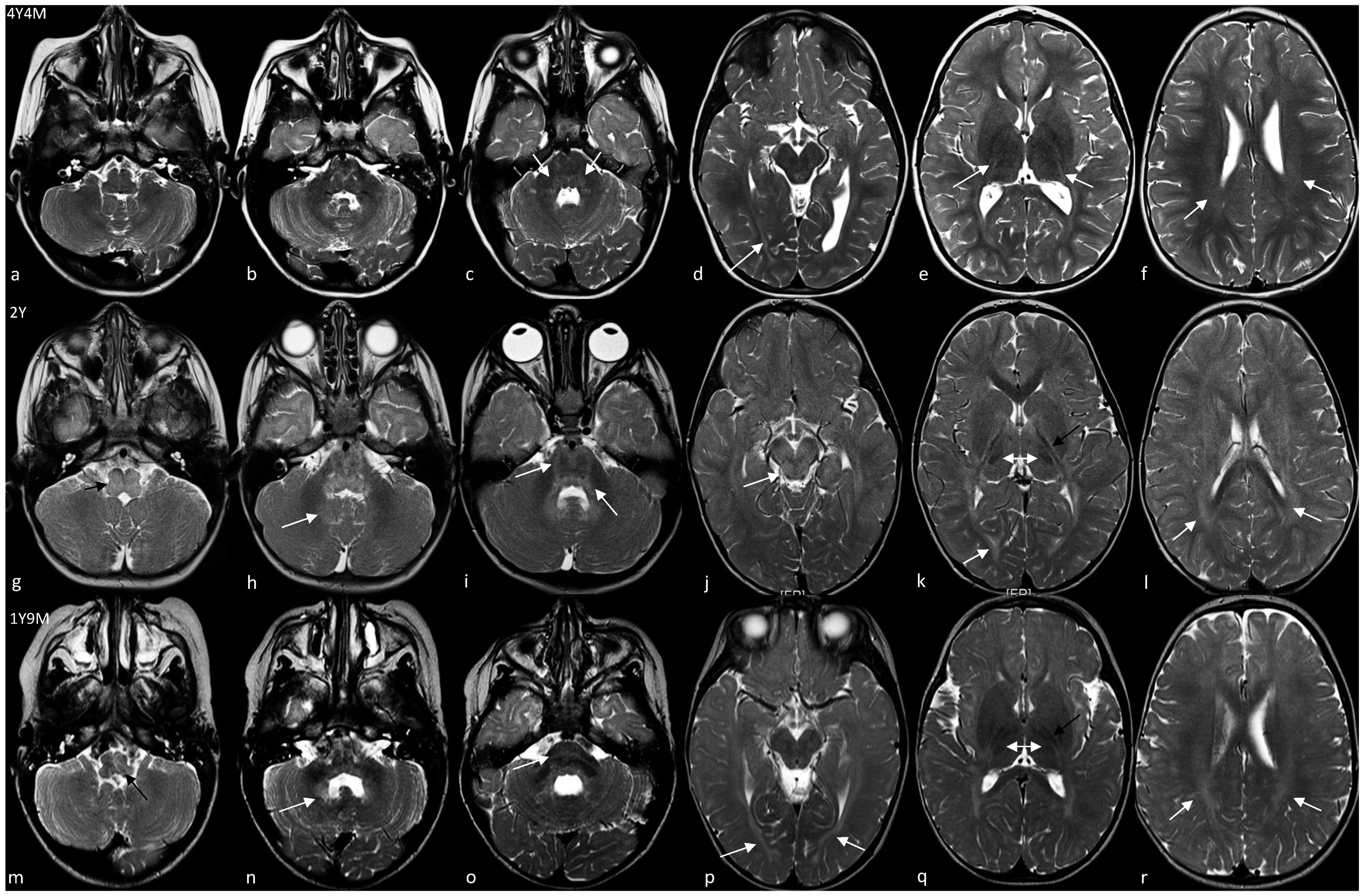 Brainsci 11 00093 g002