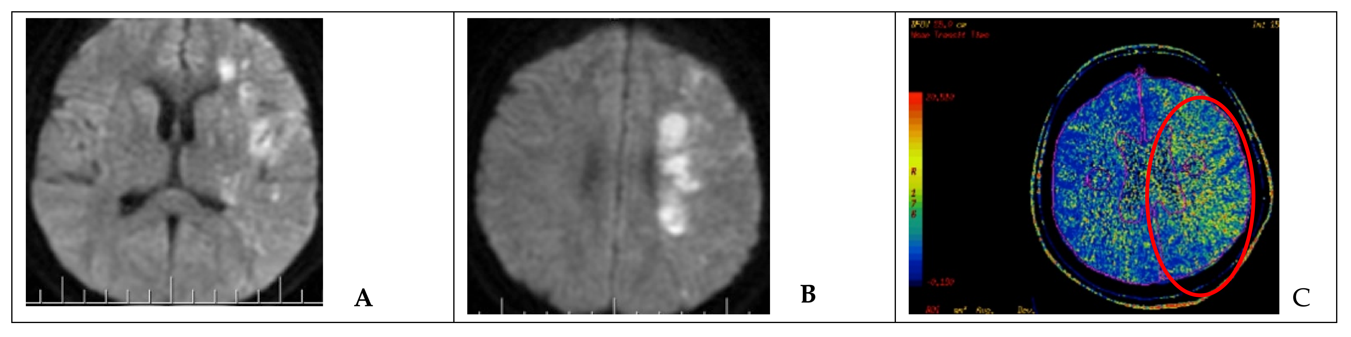 Brainsci 11 00099 g003