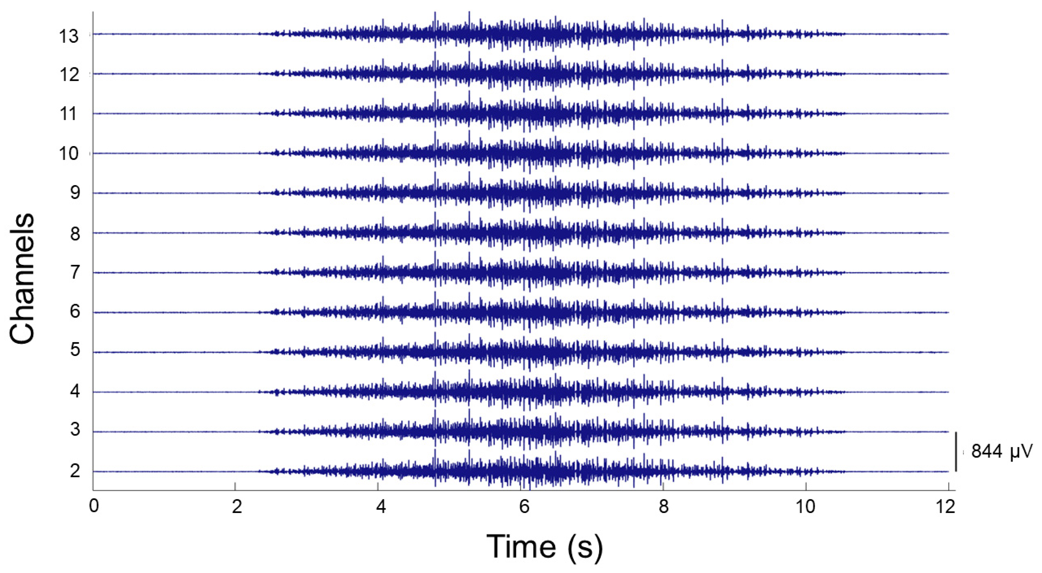 Brainsci 11 00105 g004