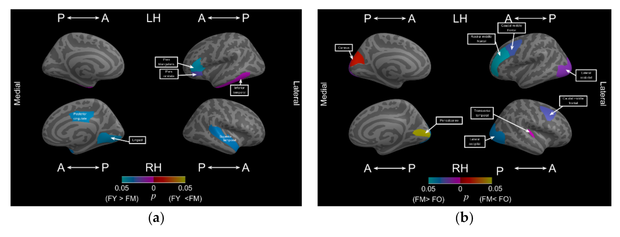 Brainsci 11 00107 g004