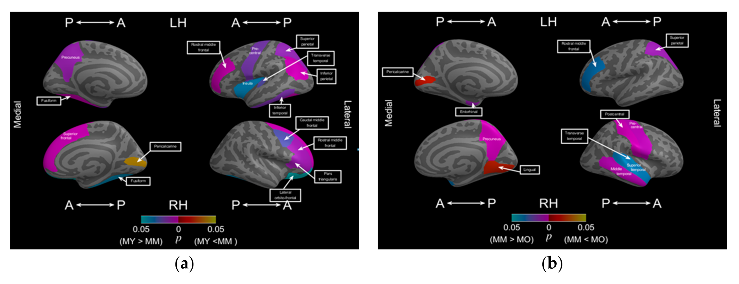Brainsci 11 00107 g005