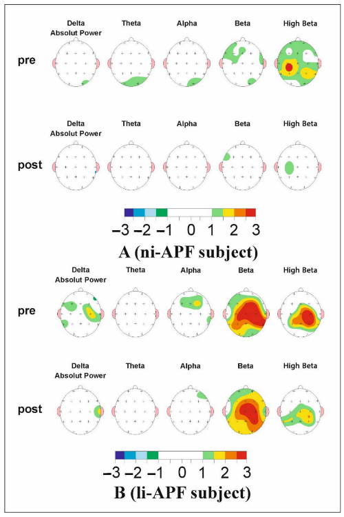 Brainsci 11 00167 g007
