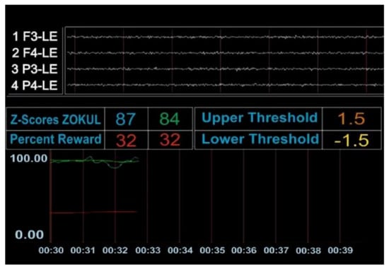 Brainsci 11 00167 g0a1a