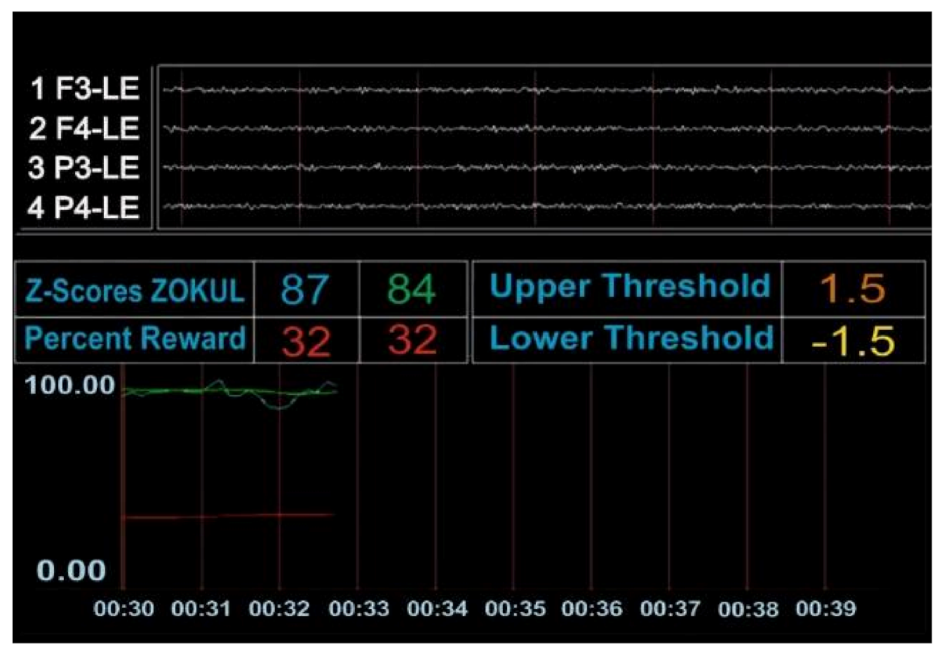 Brainsci 11 00167 g0a1a