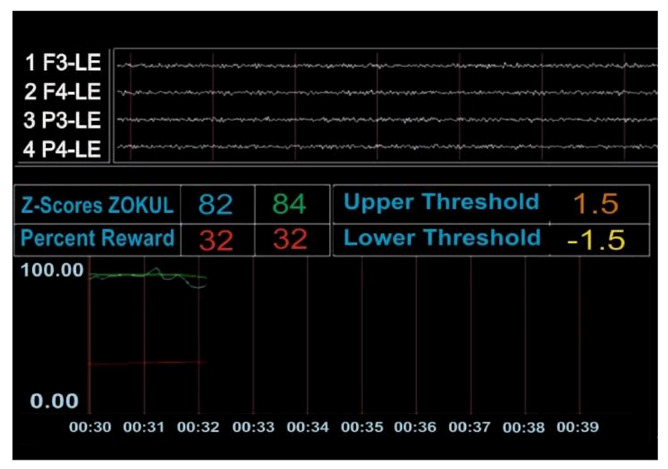 Brainsci 11 00167 g0a2a