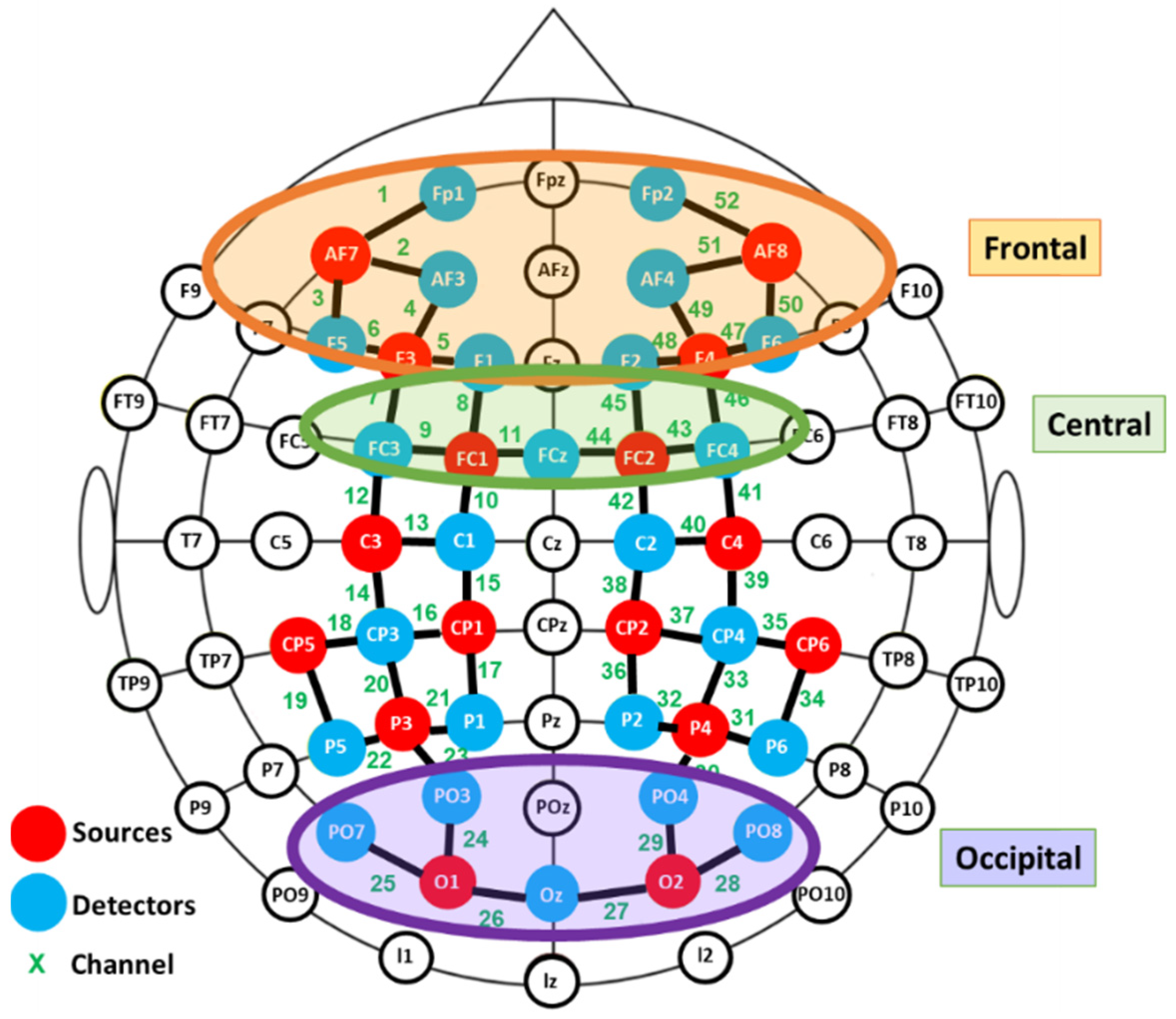 Brainsci 11 00196 g002 Brainsci 11 00196 g002