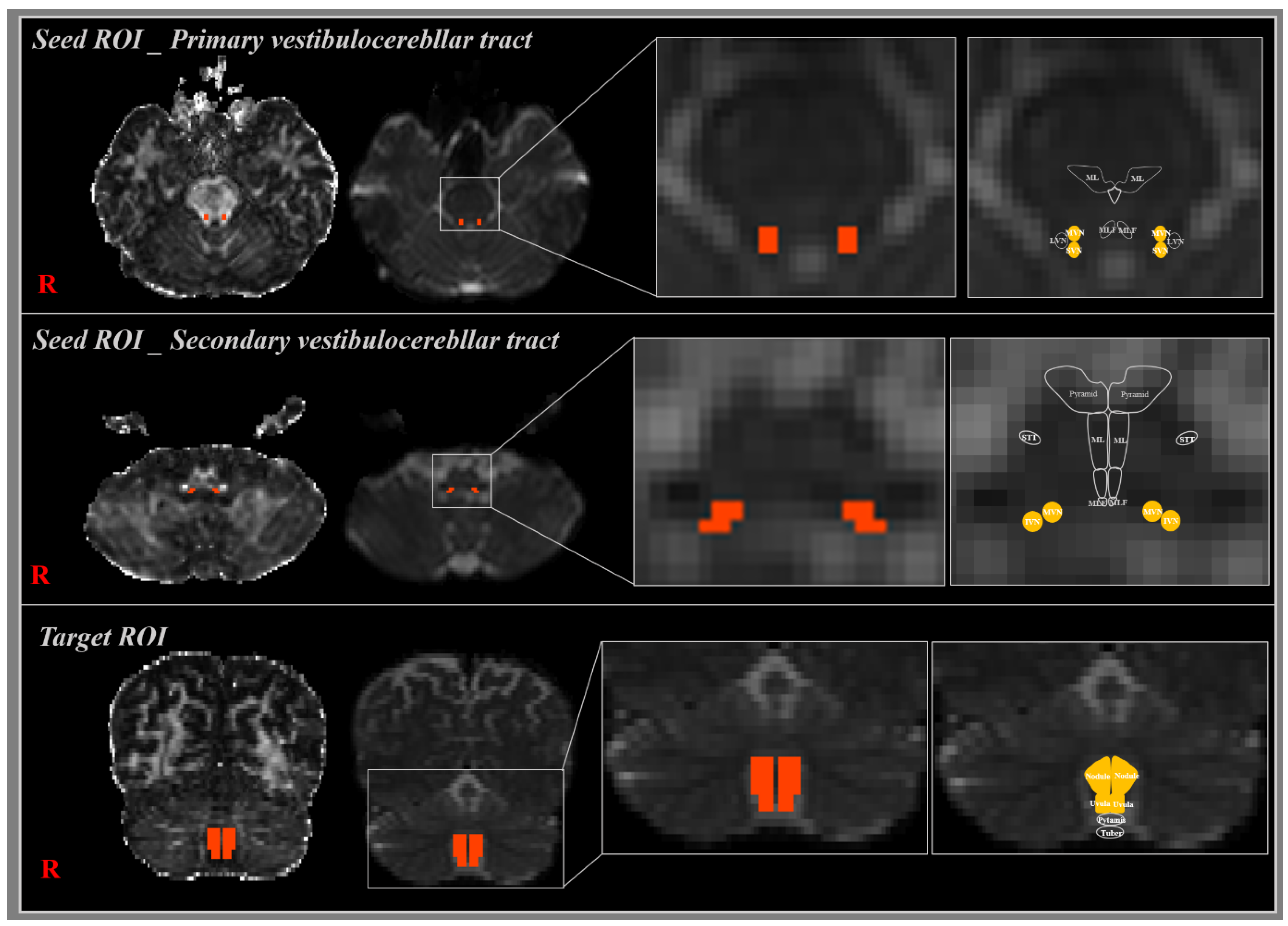Brainsci 11 00199 g001 Brainsci 11 00199 g001