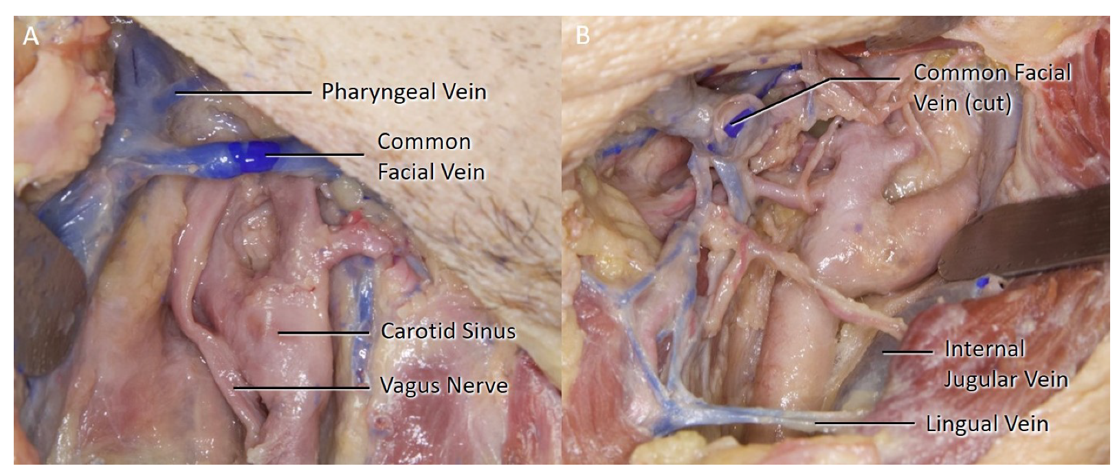 Brainsci 11 00211 g002