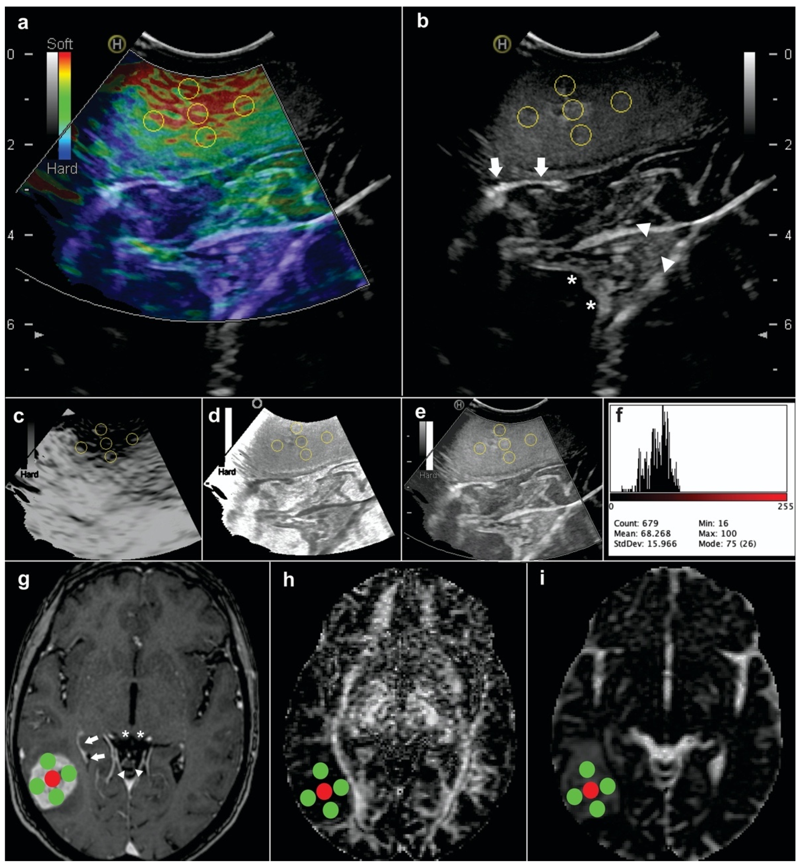Brainsci 11 00271 g002 Brainsci 11 00271 g002