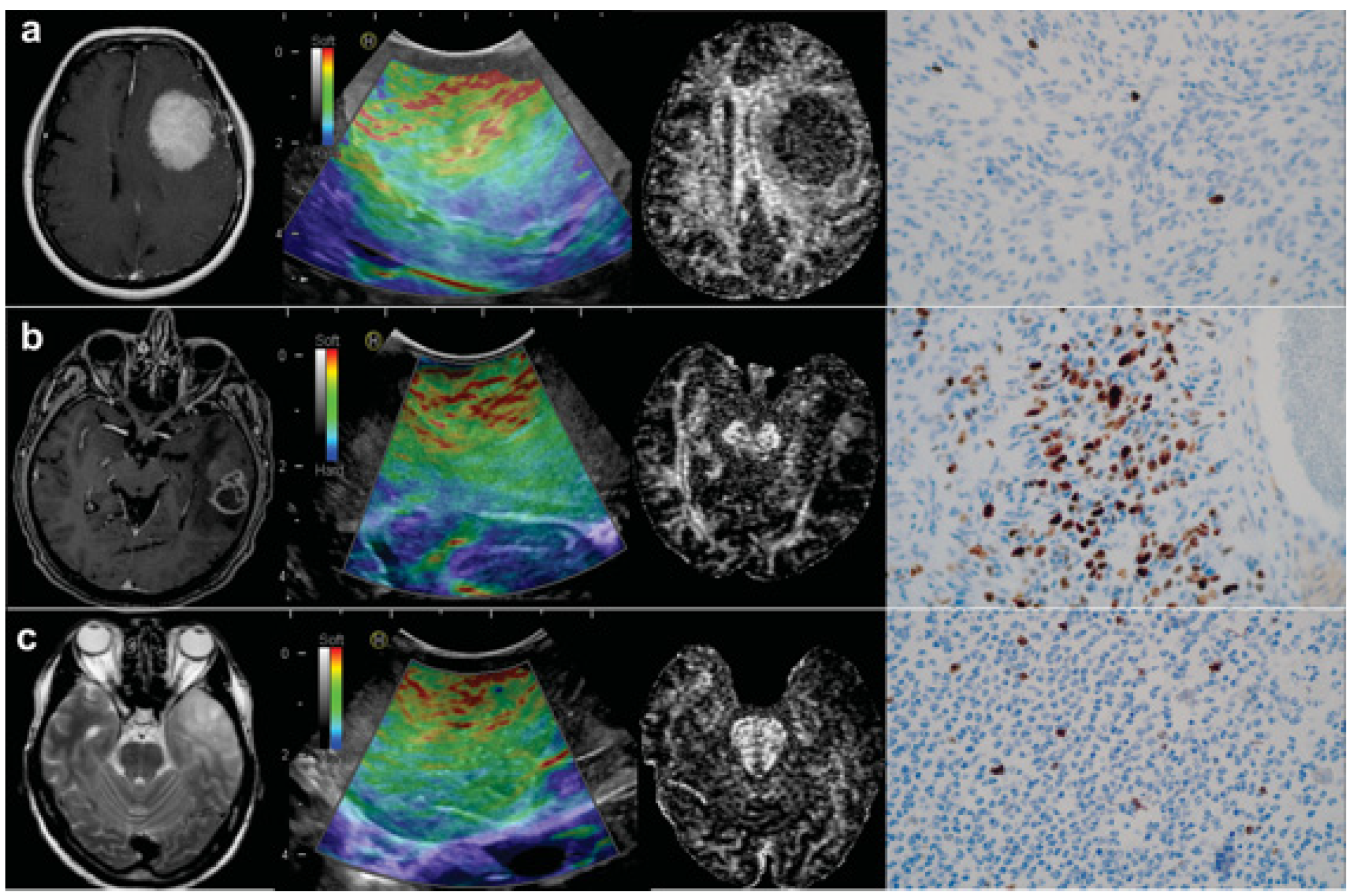 Brainsci 11 00271 g003 Brainsci 11 00271 g003