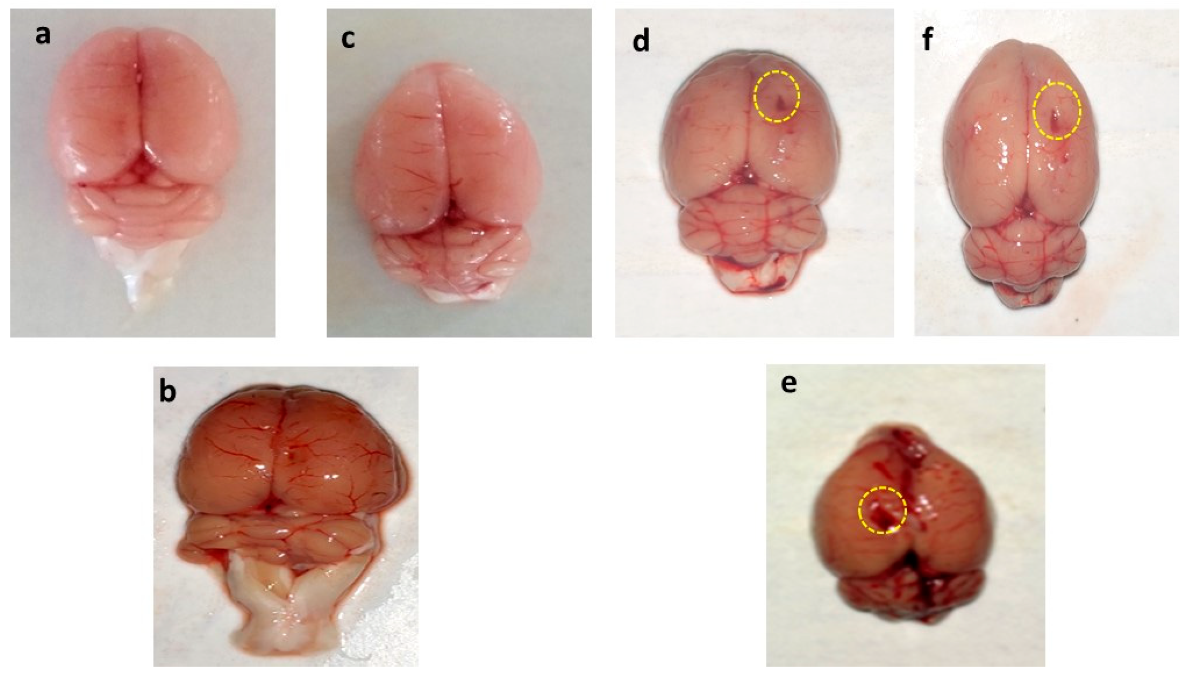 Brainsci 11 00288 g008 Brainsci 11 00288 g008