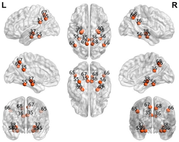 Brainsci 11 00311 i003