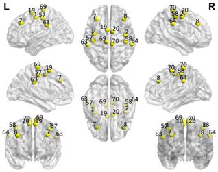 Brainsci 11 00311 i004