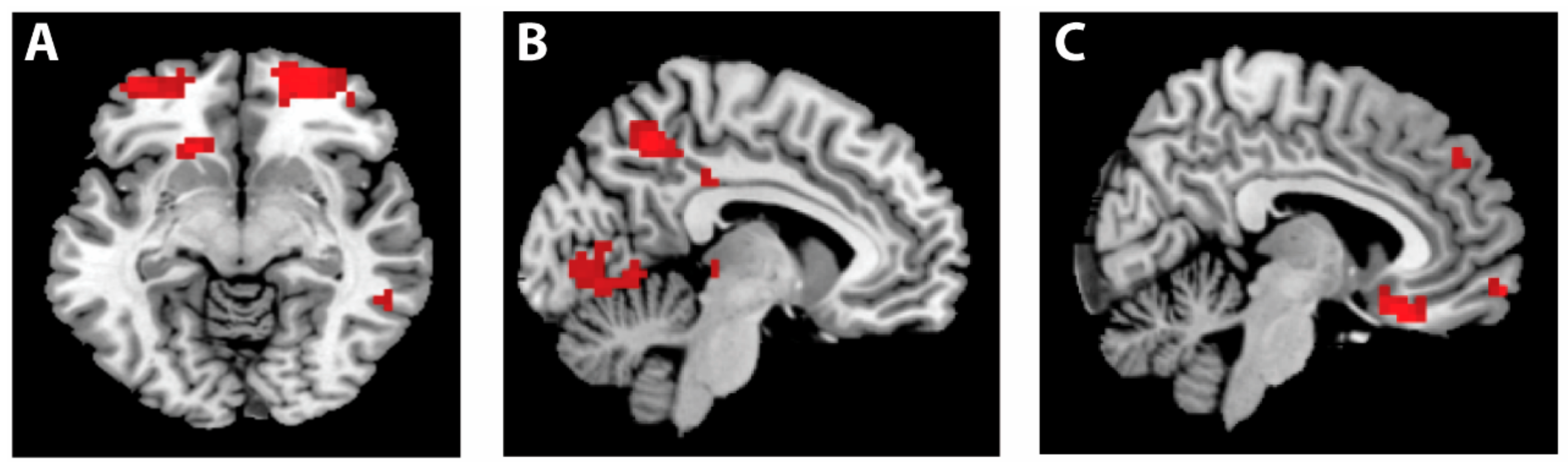 Brainsci 11 00317 g004 Brainsci 11 00317 g004