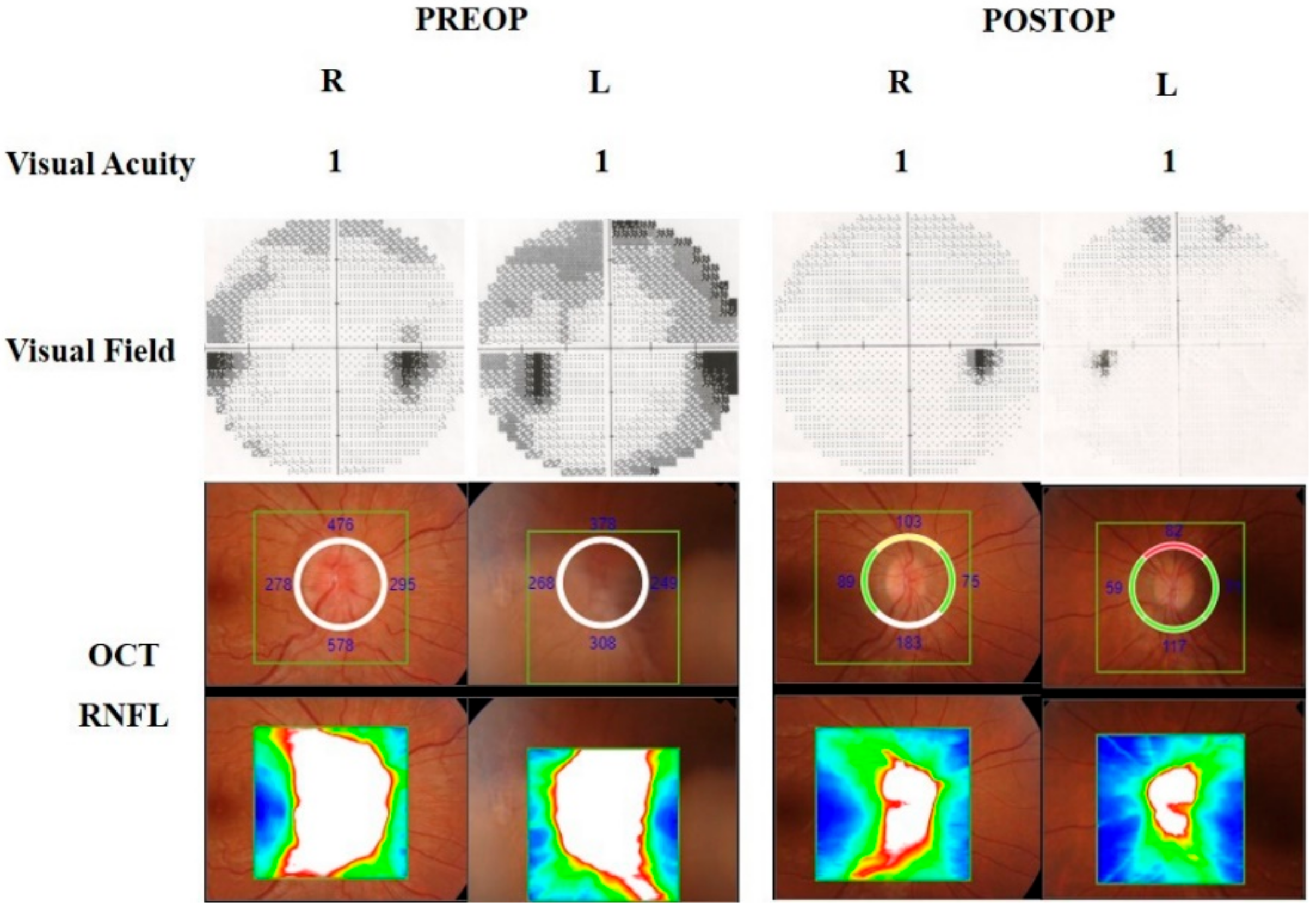 Brainsci 11 00324 g004