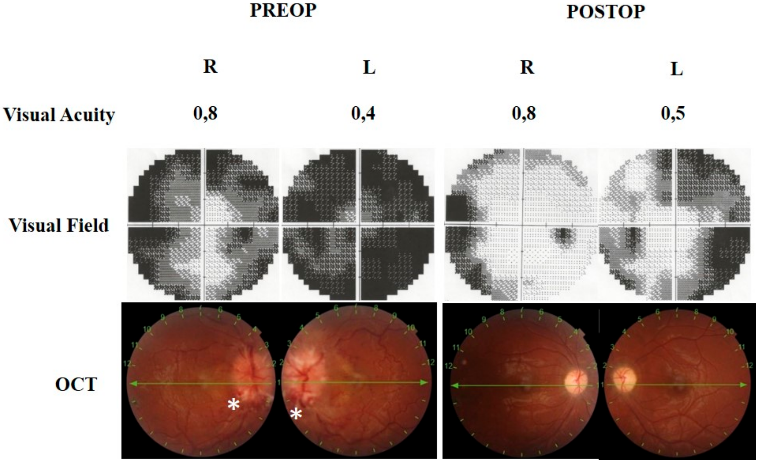 Brainsci 11 00324 g005