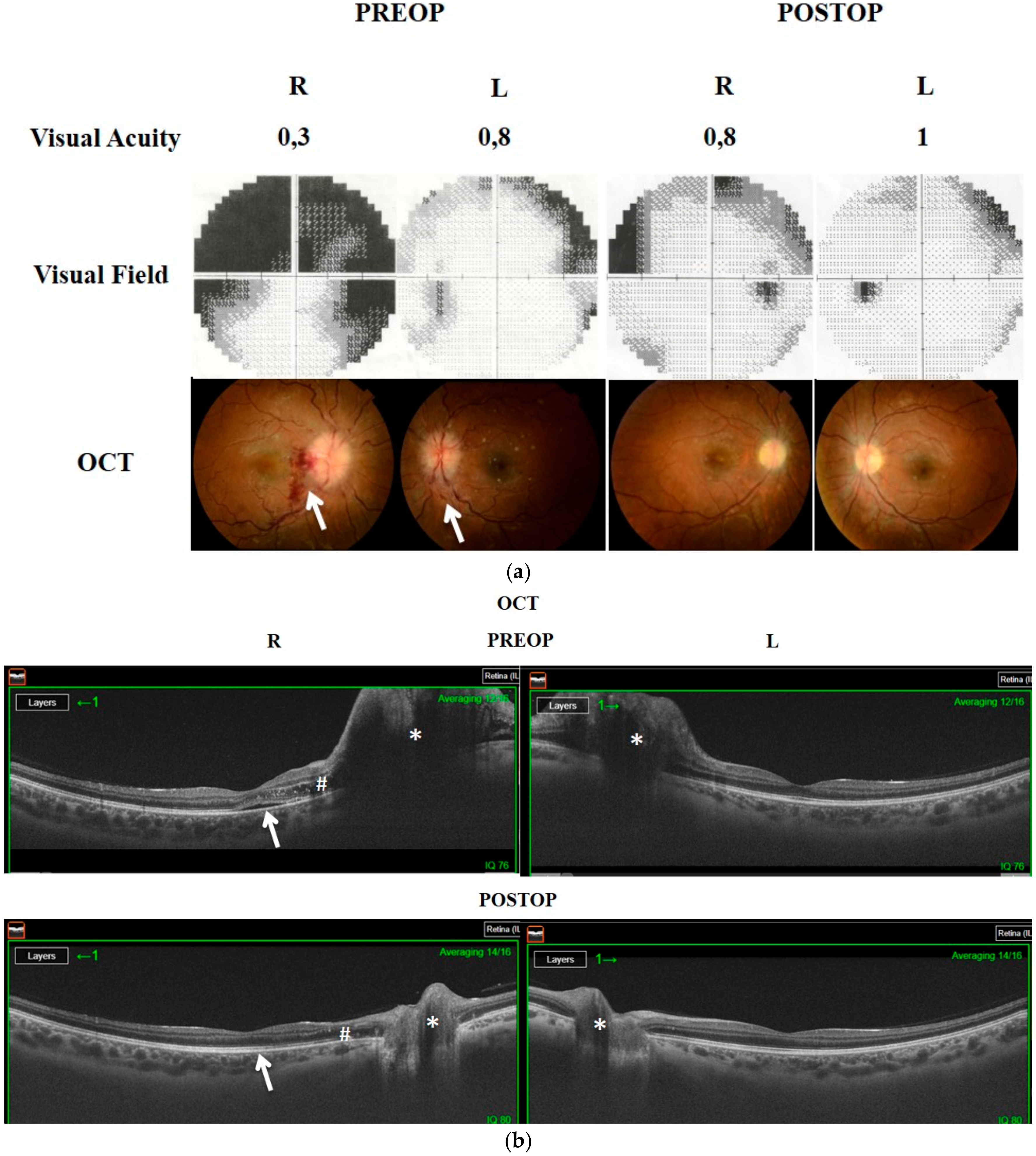 Brainsci 11 00324 g006