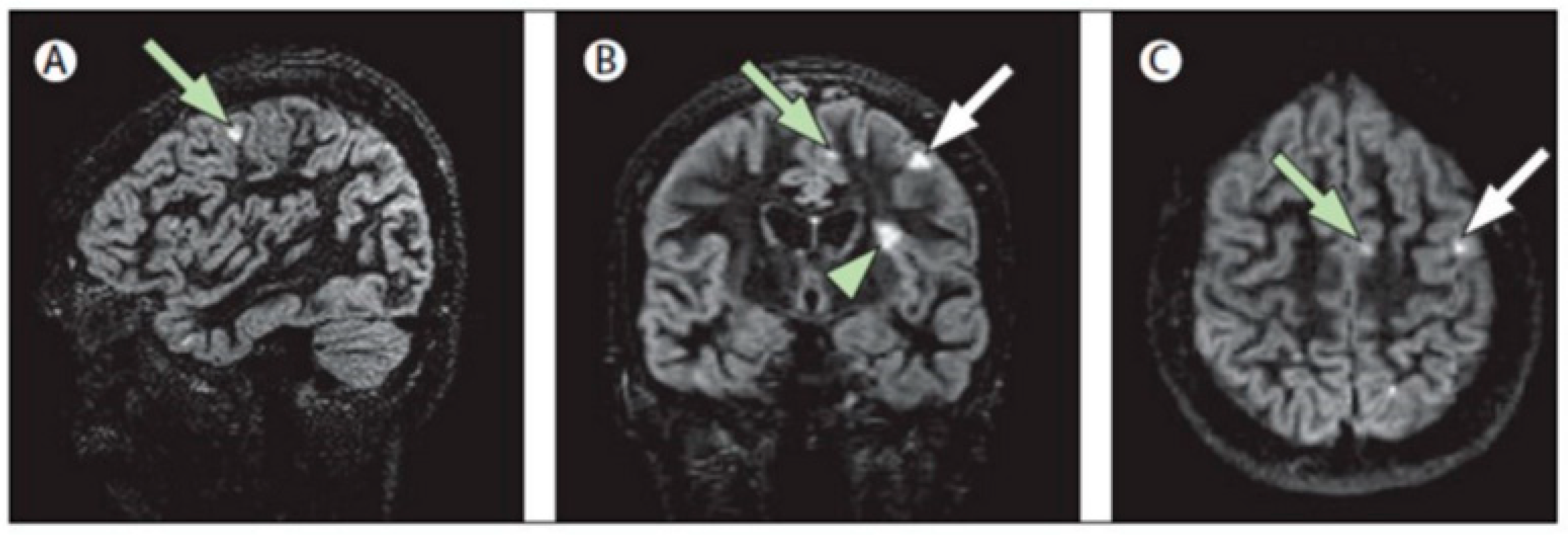 Brainsci 11 00346 g002