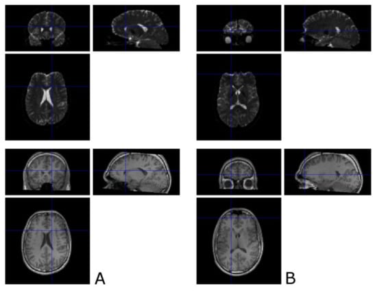 Brainsci 11 00381 g0a1