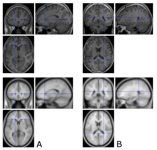 Brainsci 11 00381 g0a2