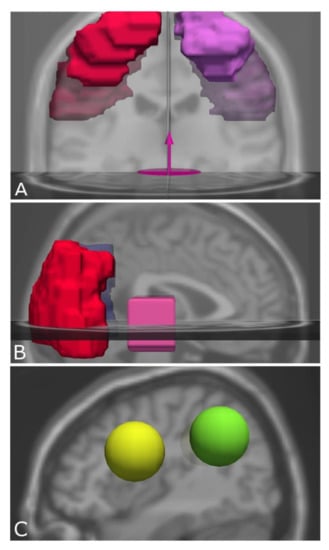Brainsci 11 00381 g0a3