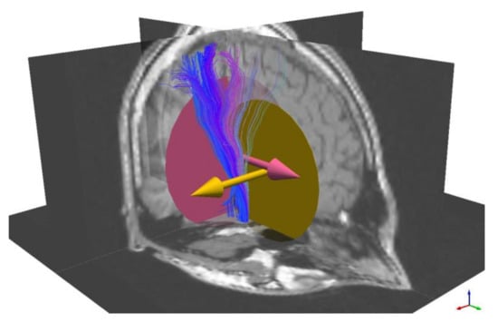 Brainsci 11 00381 g0a4