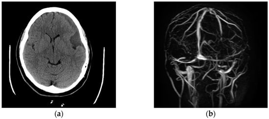 Brainsci 11 00382 g0a1