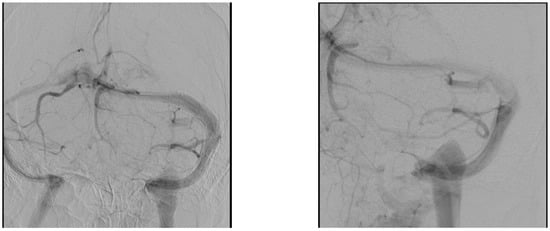 Brainsci 11 00382 g0a2