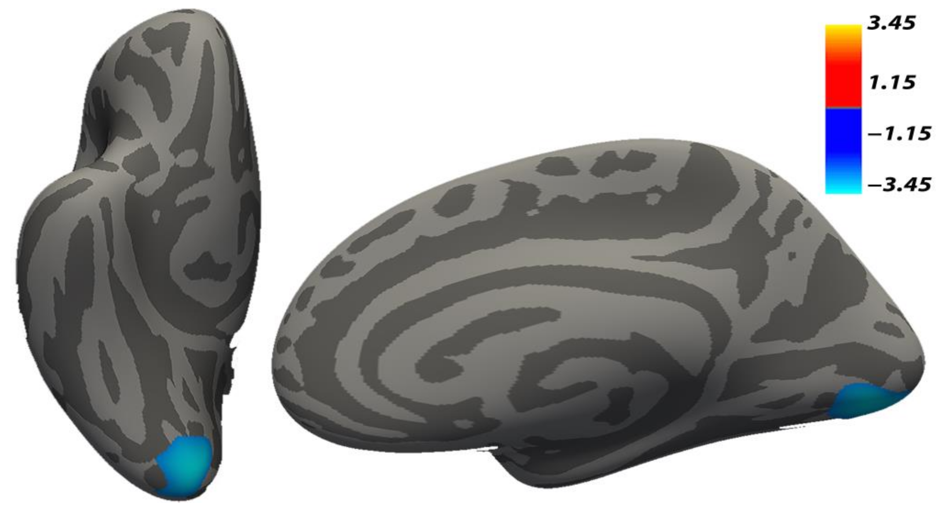Brainsci 11 00387 g002 Brainsci 11 00387 g002