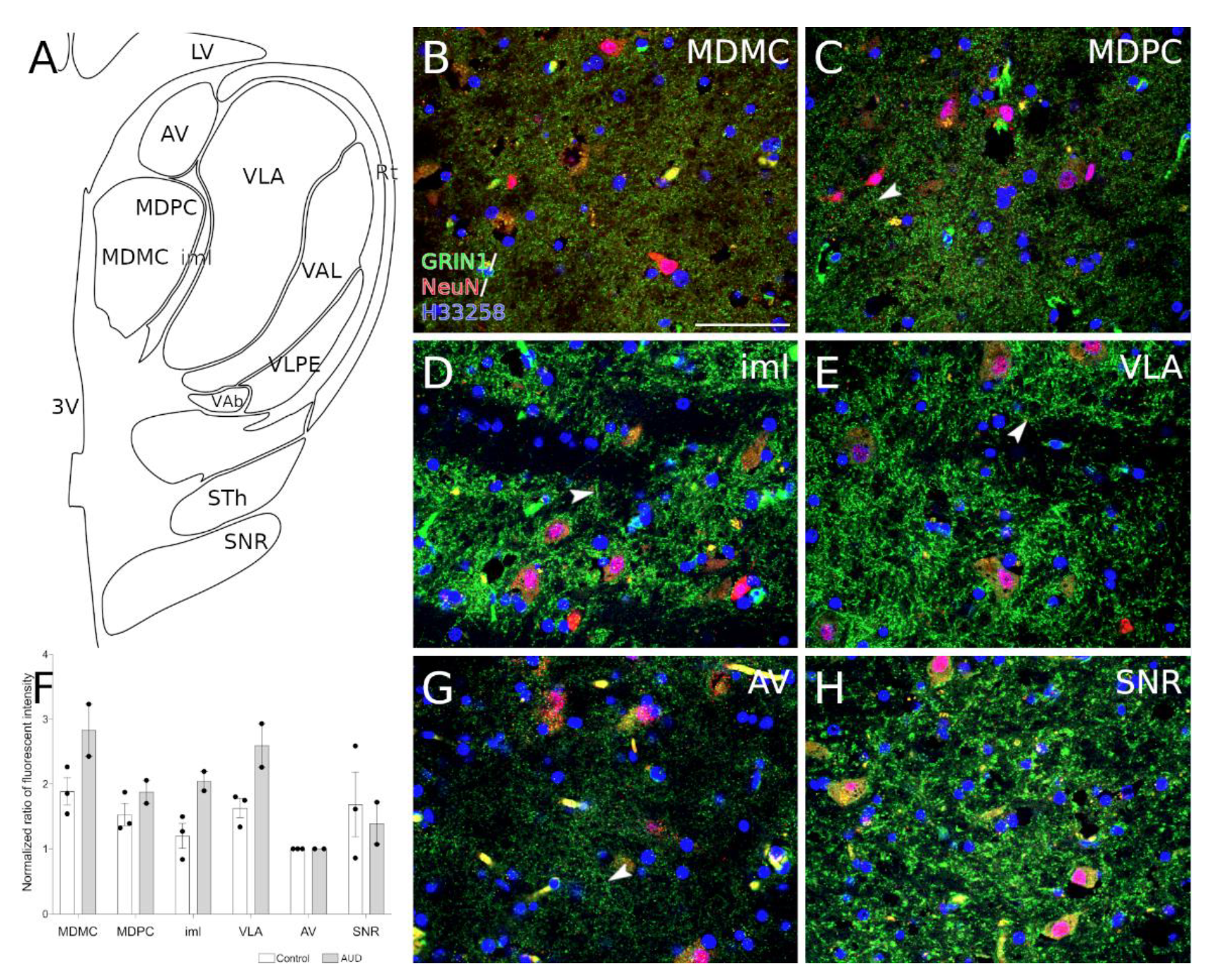 Brainsci 11 00435 g001 Brainsci 11 00435 g001