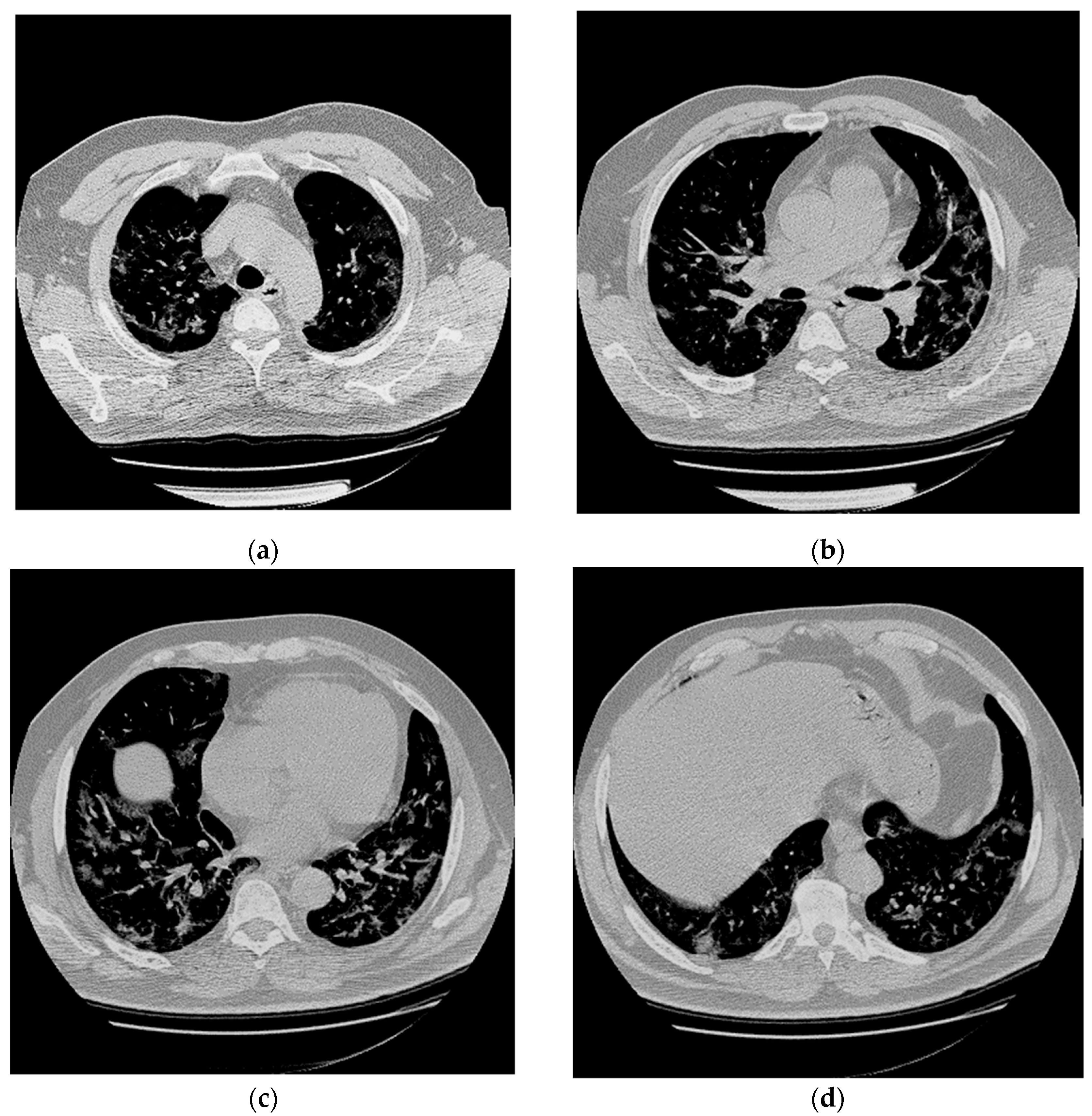 Brainsci 11 00454 g001 Brainsci 11 00454 g001