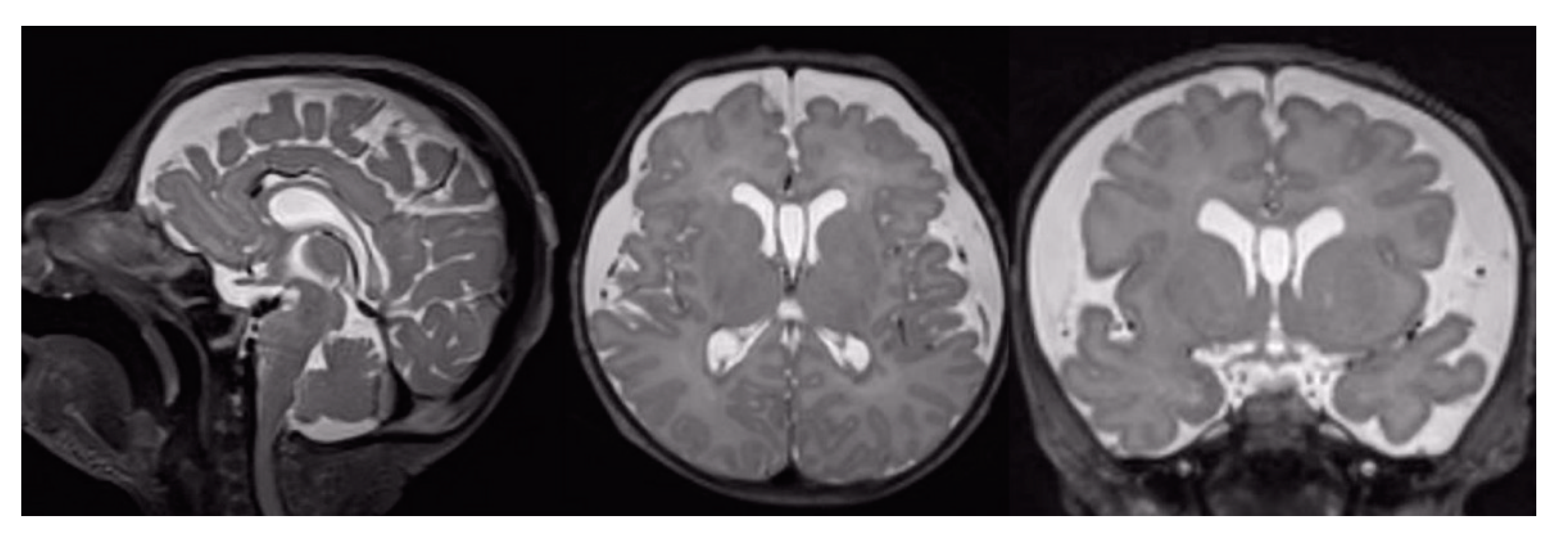 Brainsci 11 00455 g001 Brainsci 11 00455 g001