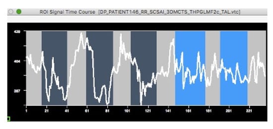 Brainsci 11 00497 g0a1