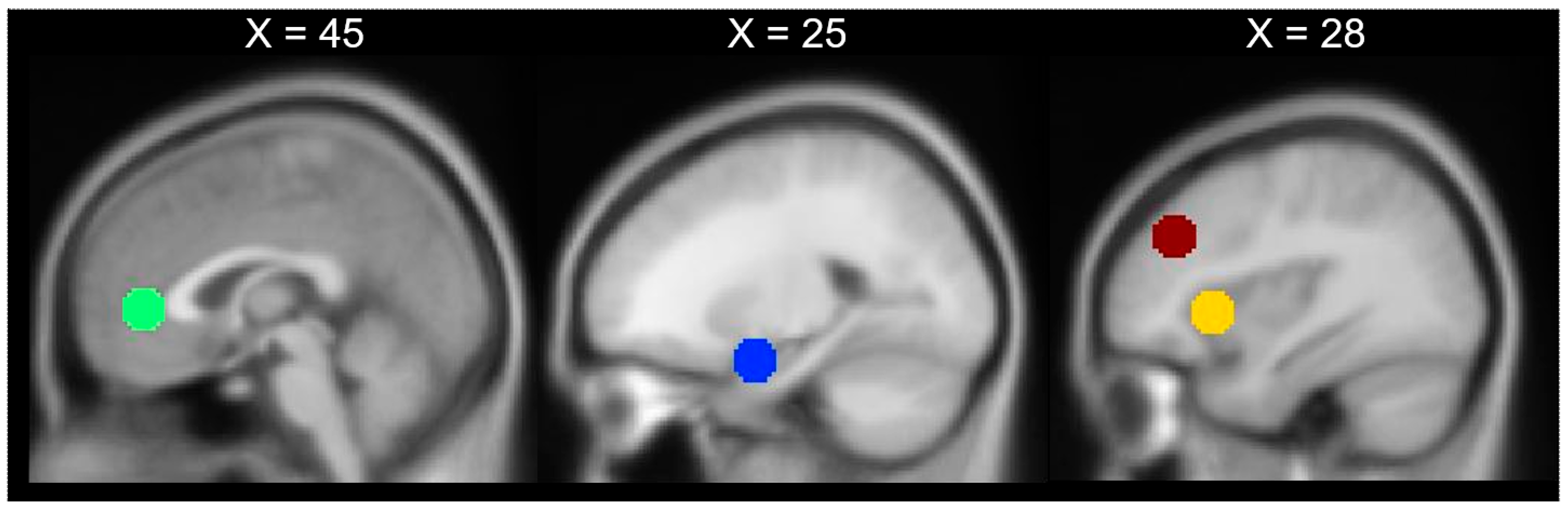 Brainsci 11 00525 g001 Brainsci 11 00525 g001