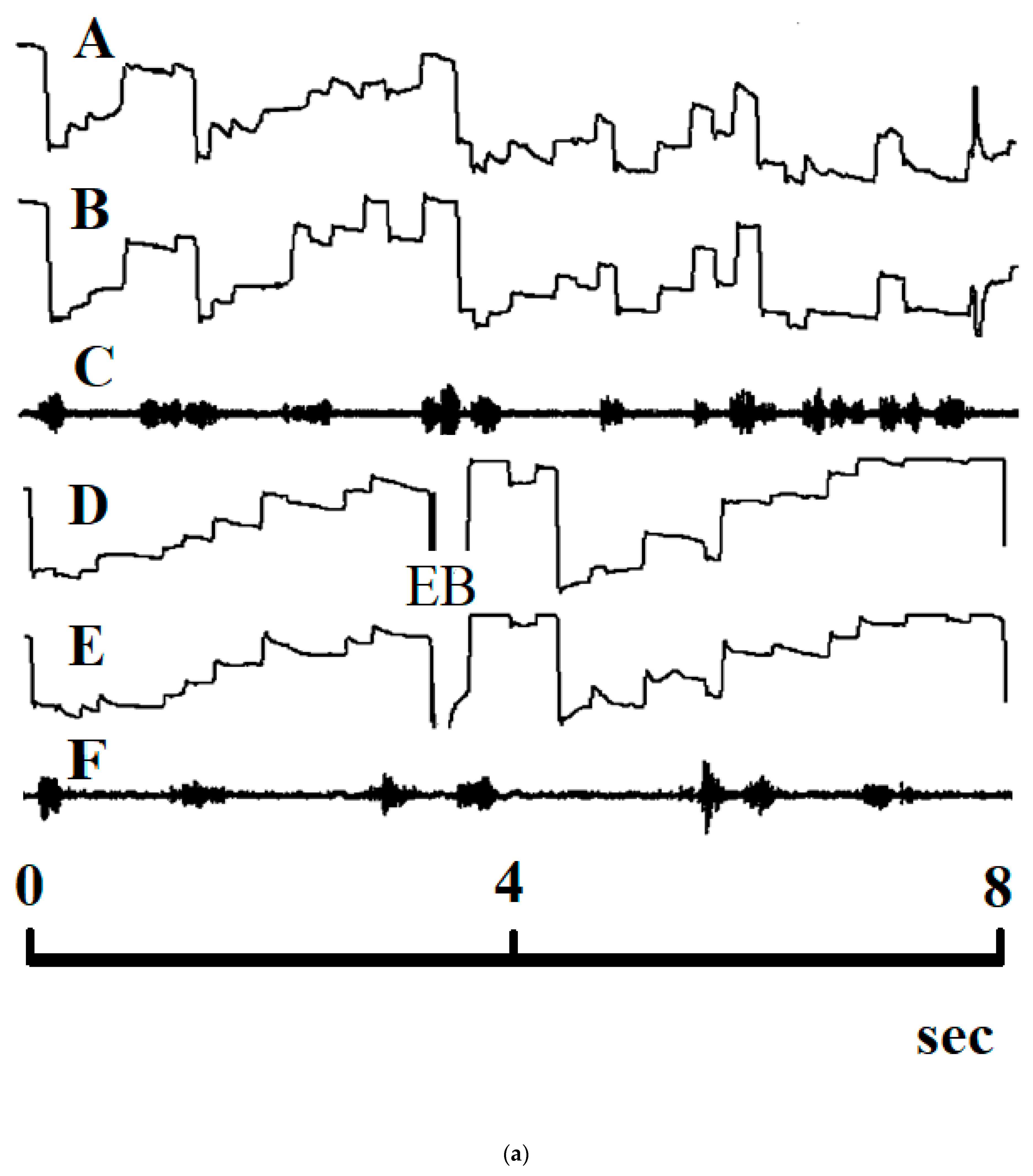 Brainsci 11 00526 g002a Brainsci 11 00526 g002a